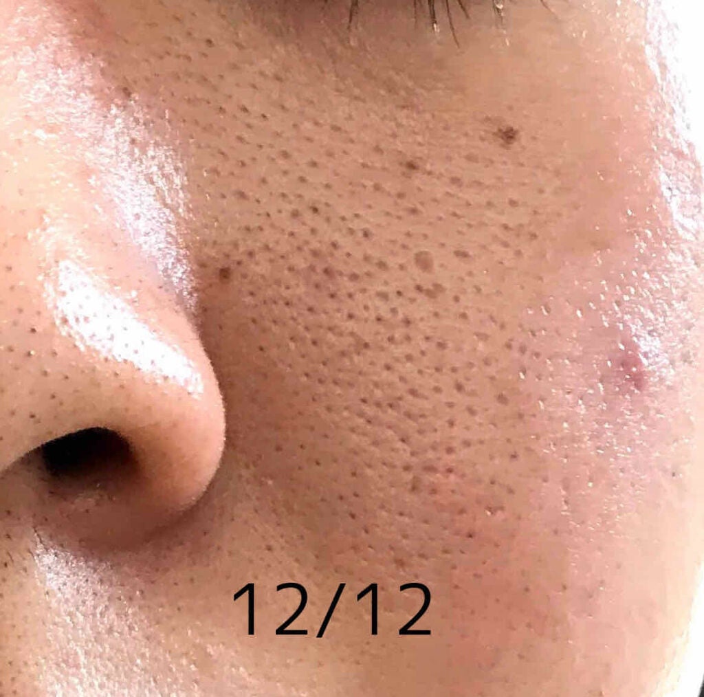 潤浸保湿 化粧水 II しっとり/キュレル/化粧水を使ったクチコミ(2枚目)