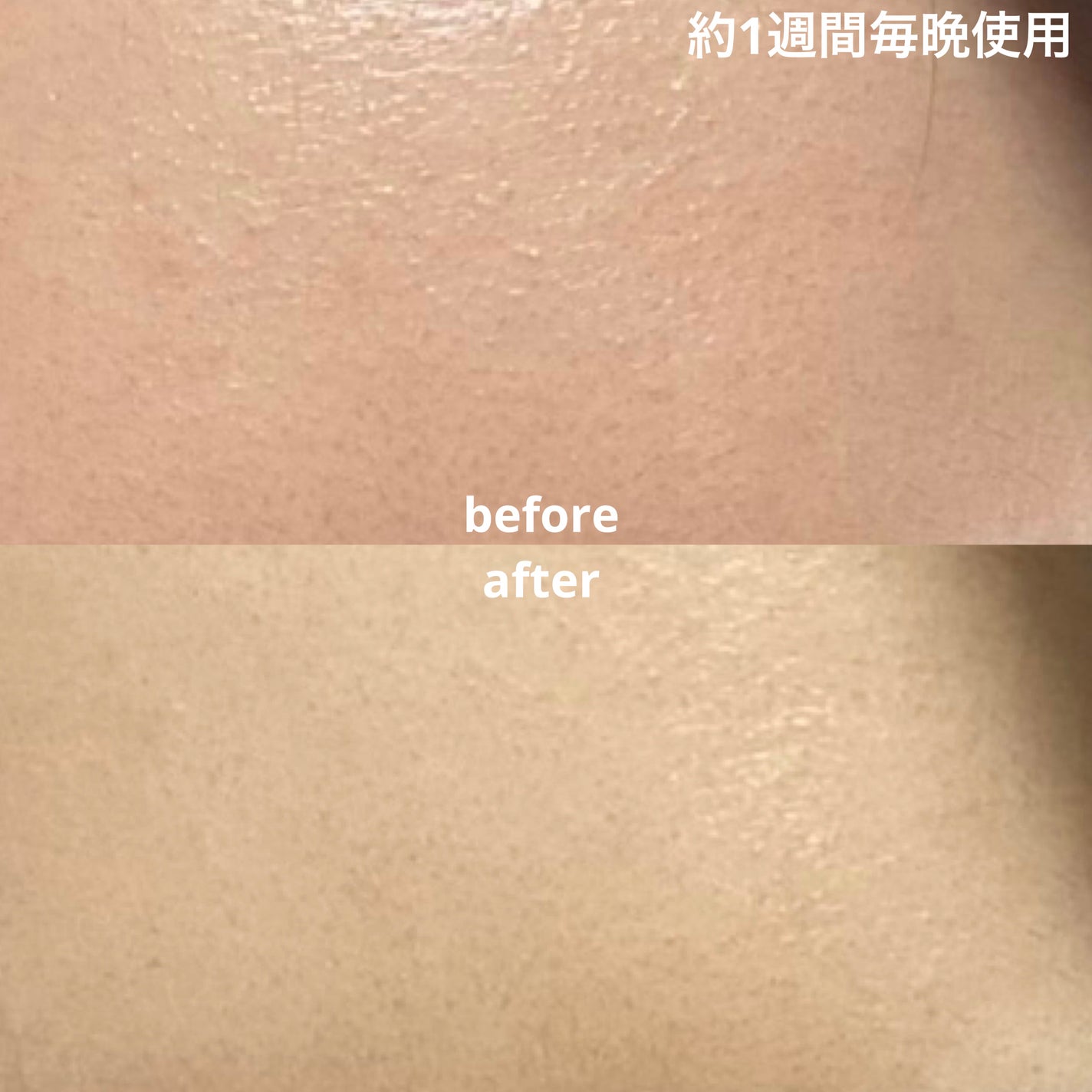 グリーンカーミングブルーレーションクリーンアンプル/obsero/美容液を使ったクチコミ(3枚目)