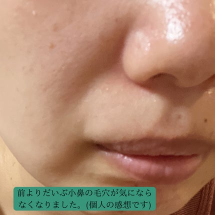 ひきしめマスク /毛穴撫子/シートマスク・パックを使ったクチコミ(3枚目)