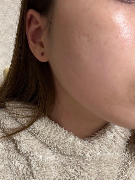 バオバブスージングモイスチャーセラム/MEDIHEAL/美容液を使ったクチコミ(2枚目)