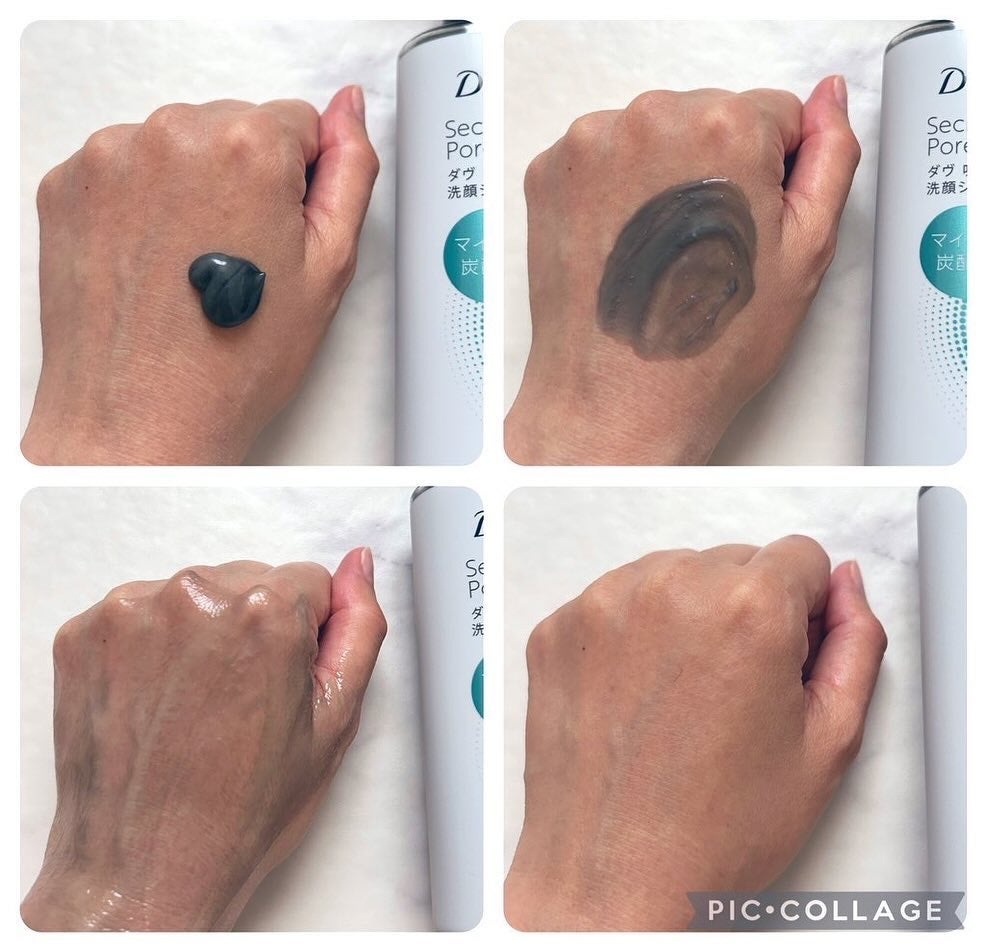 ã㎠åžçæ¯ç©Žã±ã¢ æŽé¡ãžã§ã«/ããŽ/ãã®ä»æŽé¡æã䜿ã£ãã¯ãã³ãïŒ2æç®ïŒ