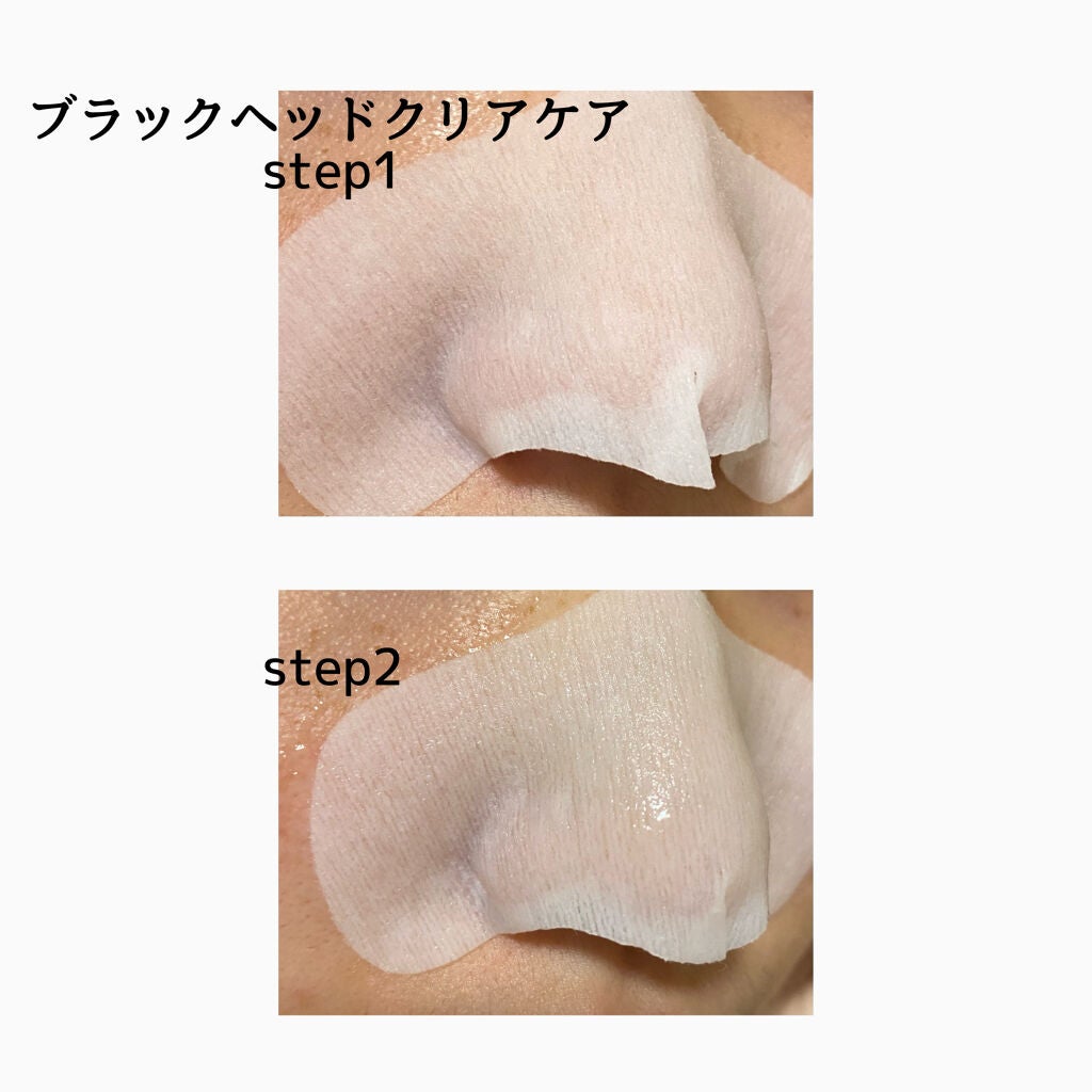 3ステップソクソクノーズパック/MEDIHEAL/シートマスク・パックを使ったクチコミ(6枚目)