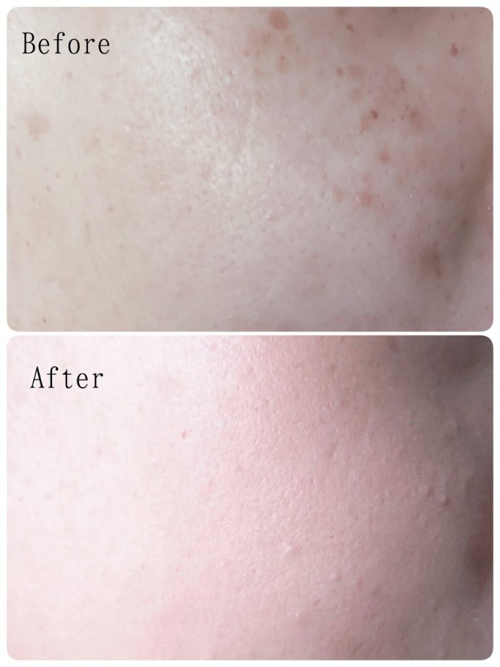 マスクフィットオールカバークッション/TIRTIR(ティルティル)/クッションファンデーションを使ったクチコミ(6枚目)