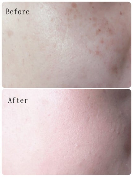 マスクフィットオールカバークッション/TIRTIR(ティルティル)/クッションファンデーションを使ったクチコミ(6枚目)