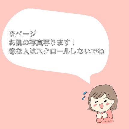 ミノン アミノモイスト モイストチャージ ローションI しっとりタイプ/ミノン/化粧水を使ったクチコミ(5枚目)