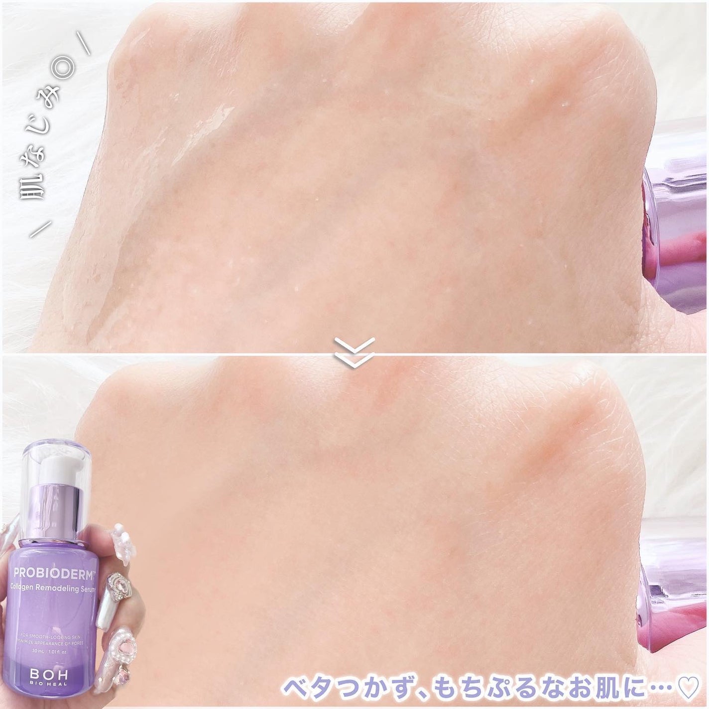 プロバイオダーム™ コラーゲンリモデリングゲルマスク/BIOHEAL BOH/シートマスク・パックを使ったクチコミ(3枚目)