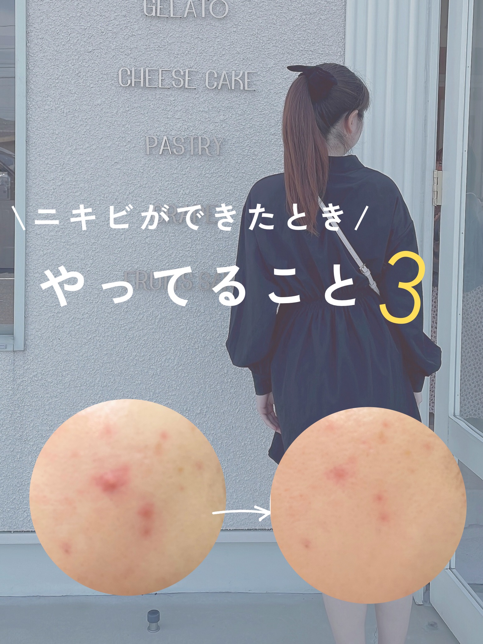 ACケア/ACROPASS/シートマスク・パックを使ったクチコミ（1枚目）