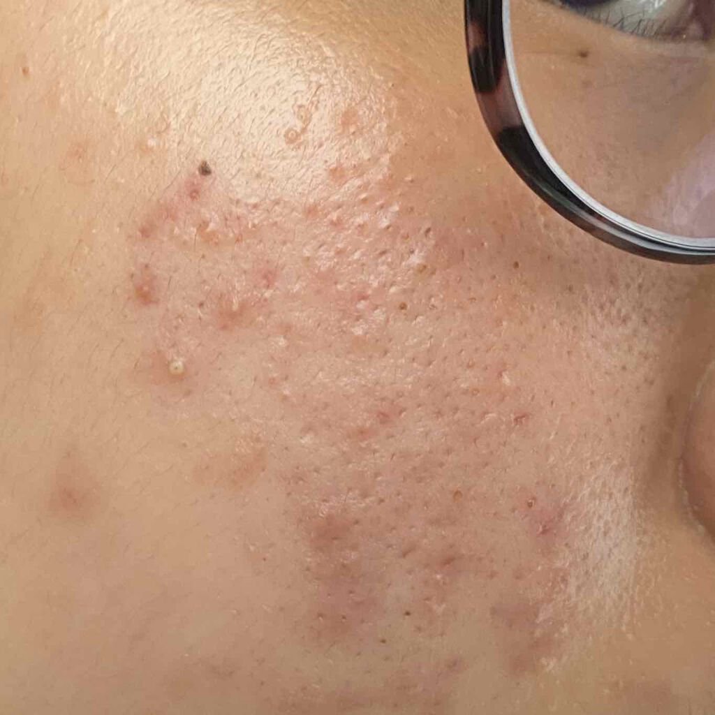 化粧水・敏感肌用・高保湿タイプ/無印良品/化粧水を使ったクチコミ(3枚目)