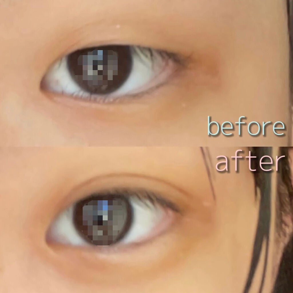 のびーるアイテープ(絆創膏タイプ、レギュラー)/DAISO/二重まぶた用アイテムを使ったクチコミ(2枚目)