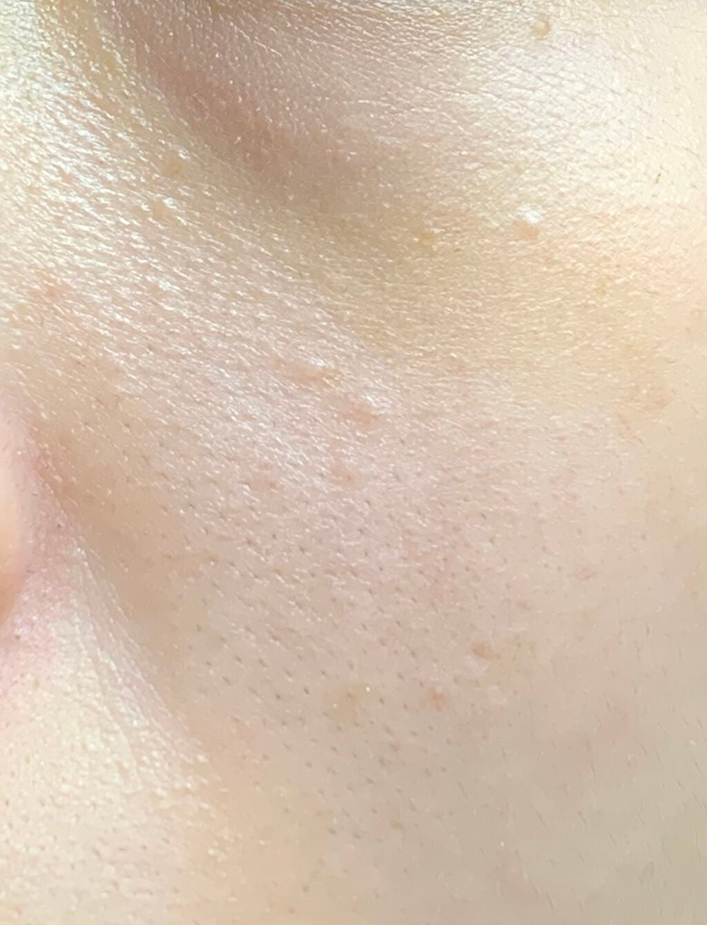 みったんちゃん on LIPS 「【助けて】毛穴?、剃れないレベルの細かな産毛(毛穴汚れに見える..」(3枚目)