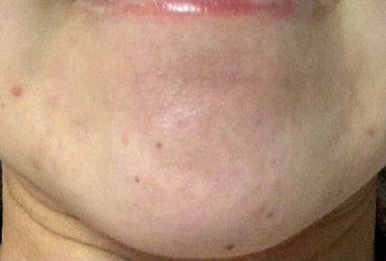 精製水(医薬品)/健栄製薬/その他を使ったクチコミ(4枚目)