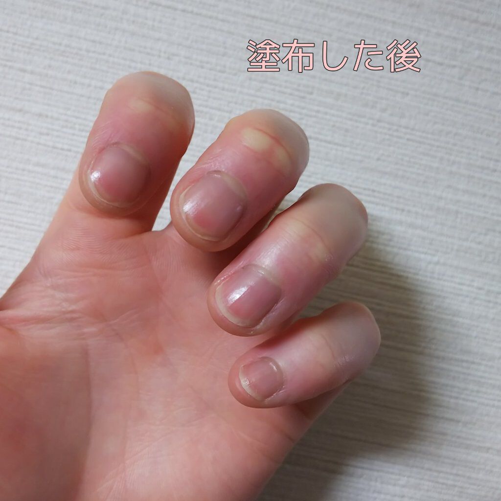 エテュセ クイックケアコート/ettusais/ネイルオイル・トリートメントを使ったクチコミ（3枚目）