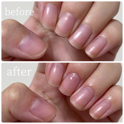 キューティクルペン/enieni /ネイルオイル・トリートメントを使ったクチコミ(4枚目)