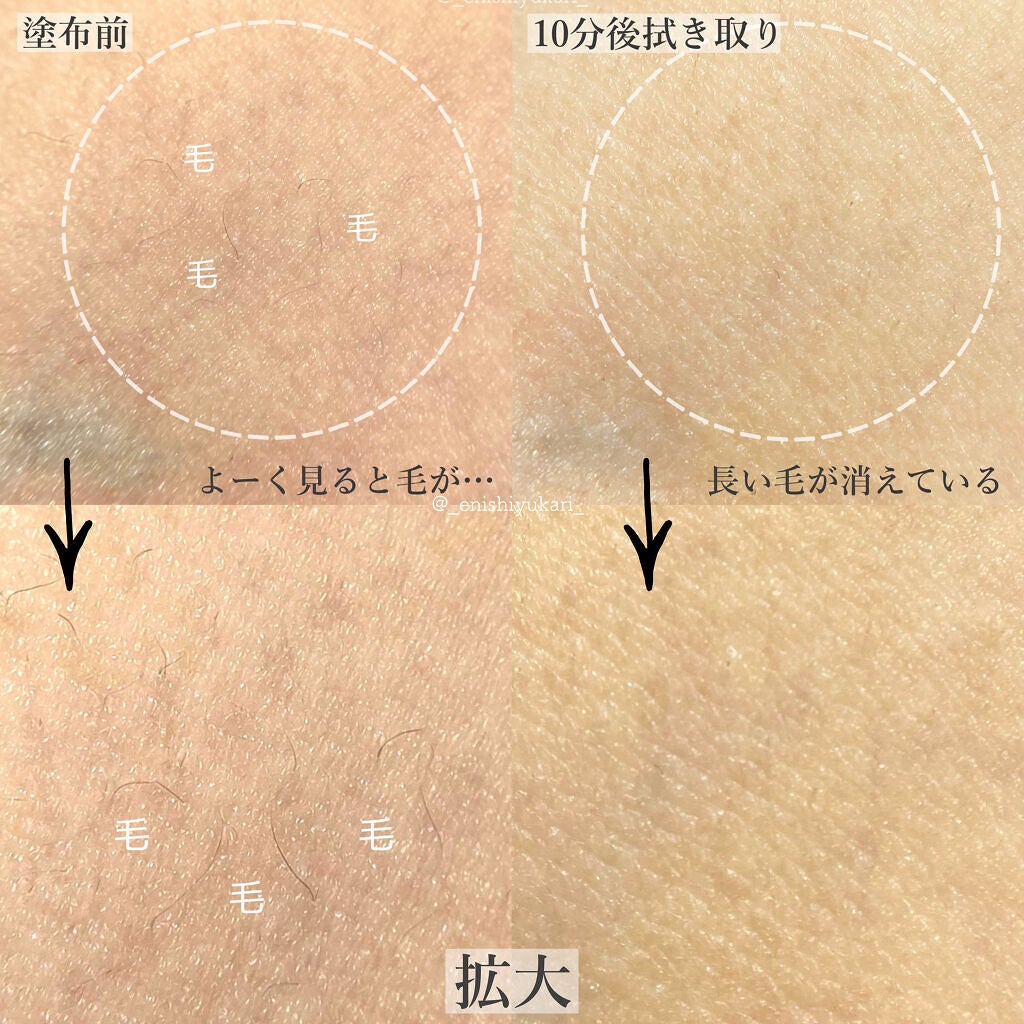 エピリムーバー N/TBC/除毛クリームを使ったクチコミ(6枚目)