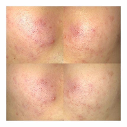 すっぴんパウダー/クラブ/プレストパウダーを使ったクチコミ(1枚目)