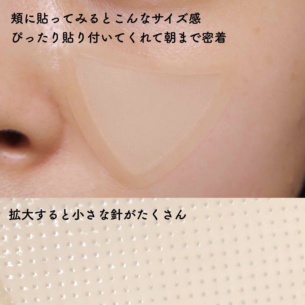 チークポアパッチ/北の快適工房/シートマスク・パックを使ったクチコミ(3枚目)