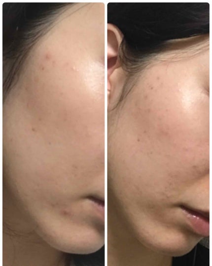 アルビオン 薬用スキンコンディショナー エッセンシャル/ALBION/化粧水を使ったクチコミ(3枚目)