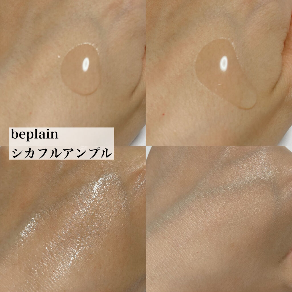 ドクダミ 77 スージングトナー/Anua/化粧水を使ったクチコミ（3枚目）