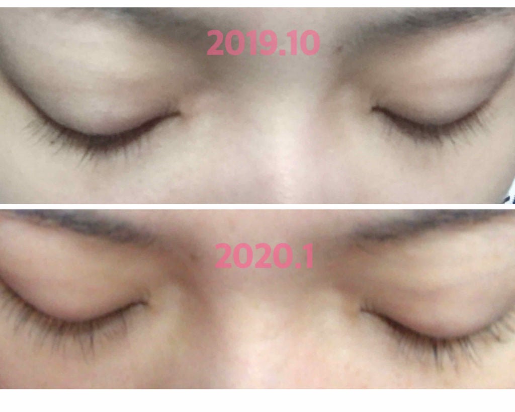 げんちゃん❤︎フォロバ100% on LIPS 「まつ毛美容液ケアプロストのご紹介です🥰4ヶ月間使ってみて効果を..」(1枚目)