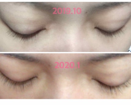 げんちゃん❤︎フォロバ100% on LIPS 「まつ毛美容液ケアプロストのご紹介です🥰4ヶ月間使ってみて効果を..」(1枚目)