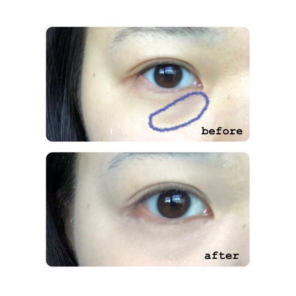 ビッグカバーフィットコンシーラー/ETUDE/リキッドコンシーラーを使ったクチコミ(2枚目)