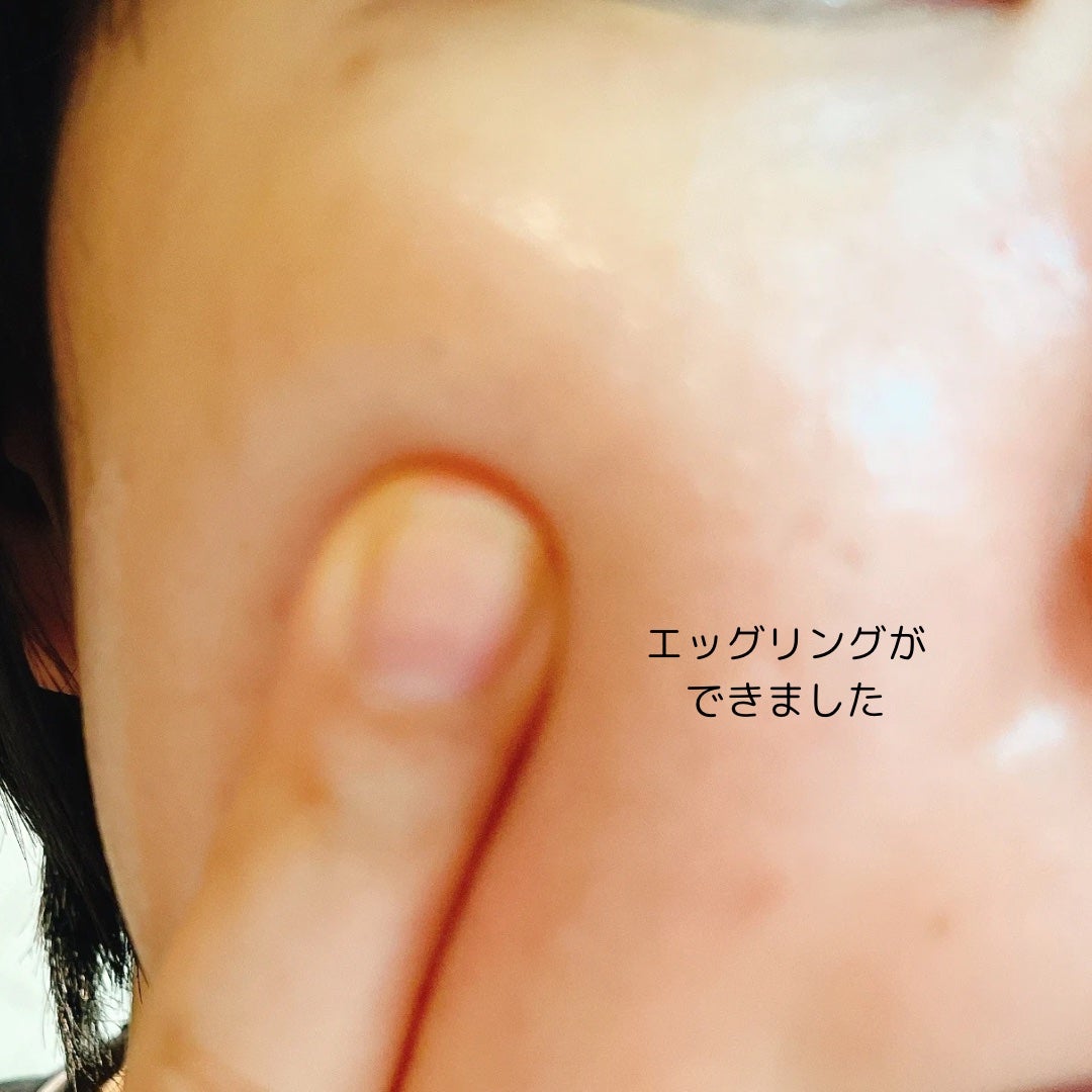 BADECASIL DERMASEAL MASK/23years old/シートマスク・パックを使ったクチコミ(8枚目)