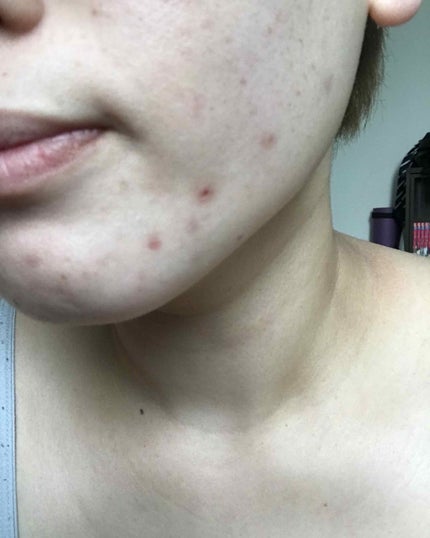 メディキューブレッドクッション/MEDICUBE/クッションファンデーションを使ったクチコミ(3枚目)