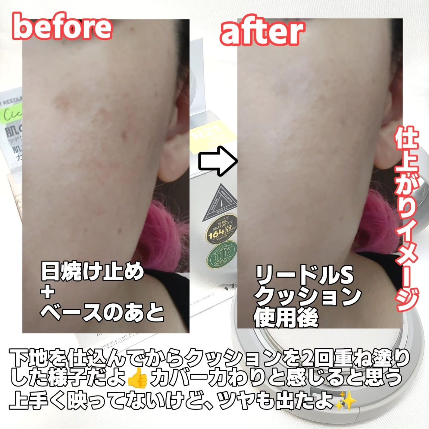 リードルS マイルドクッション/VT/クッションファンデーションを使ったクチコミ(7枚目)