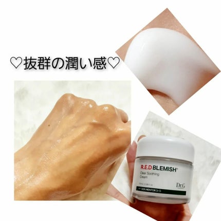 TOMOKO on LIPS 「♡・・・・・・・・・・♡Dr.G/ドクタージ-【レッドブレミッ..」(4枚目)