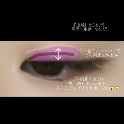 ケアリーヴ/ニチバン/その他を使ったクチコミ(3枚目)