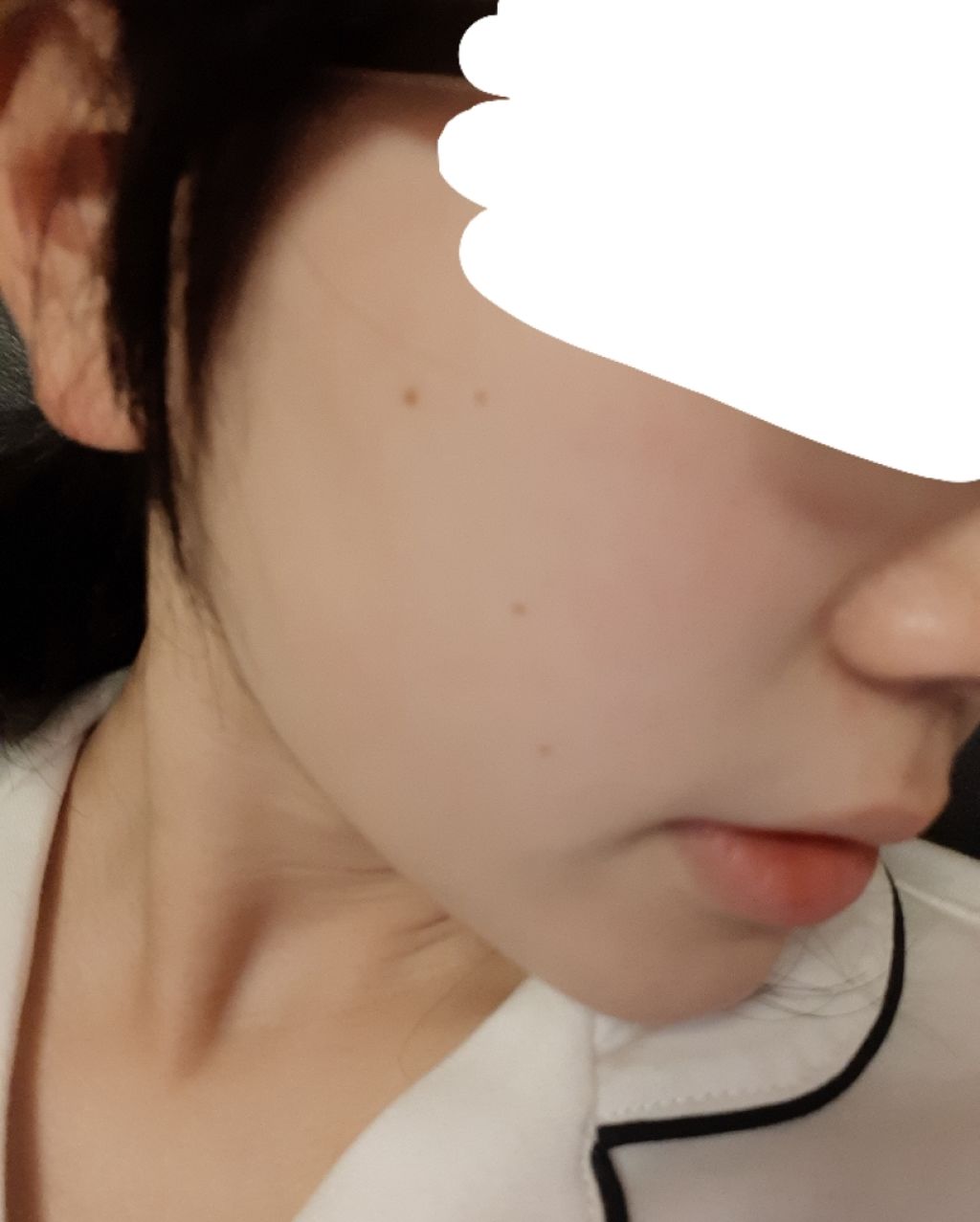 ロゼット洗顔パスタ アクネクリア/ロゼット/洗顔フォームを使ったクチコミ(2枚目)