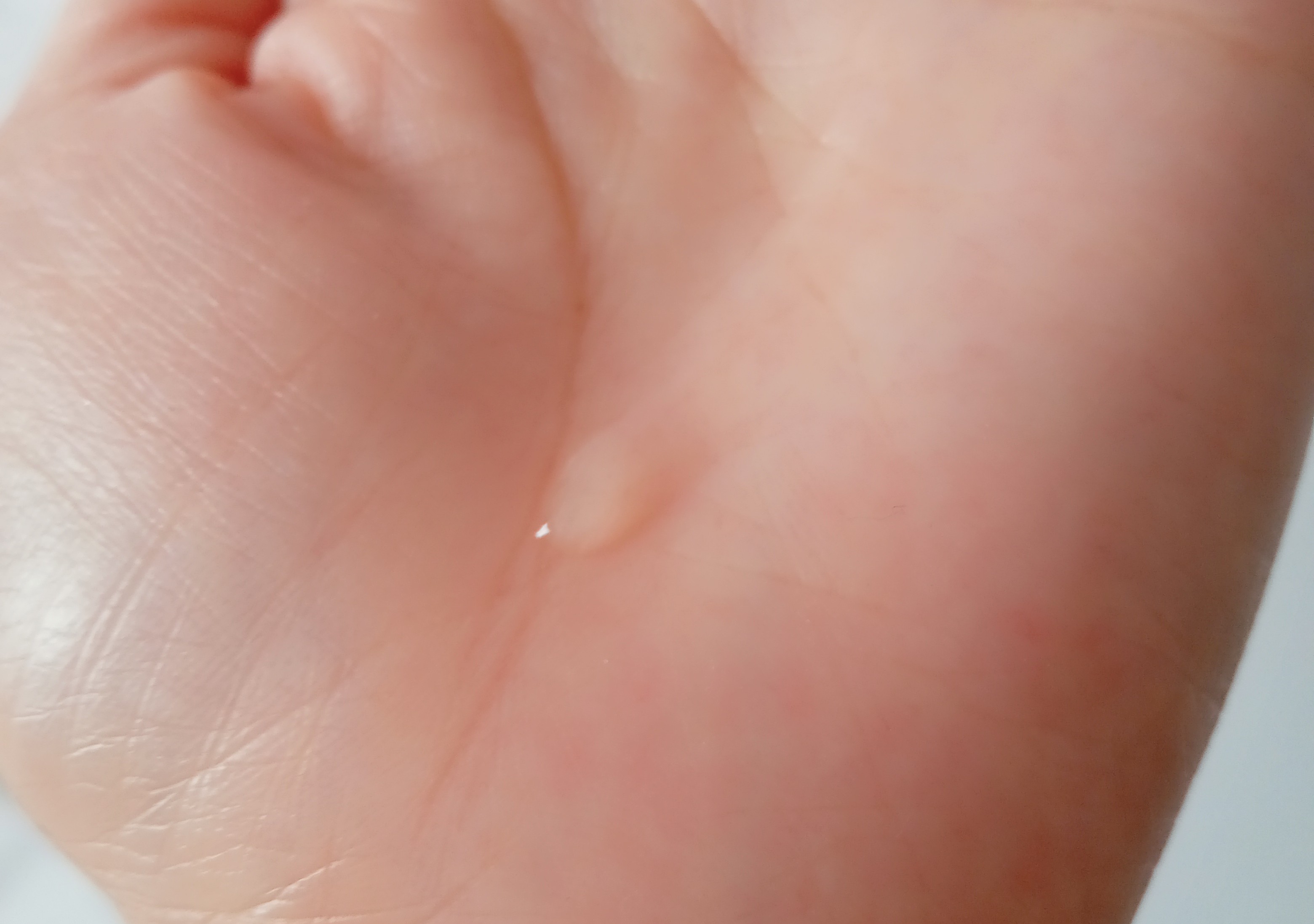 センテラ アンプル/SKIN1004/美容液を使ったクチコミ（3枚目）