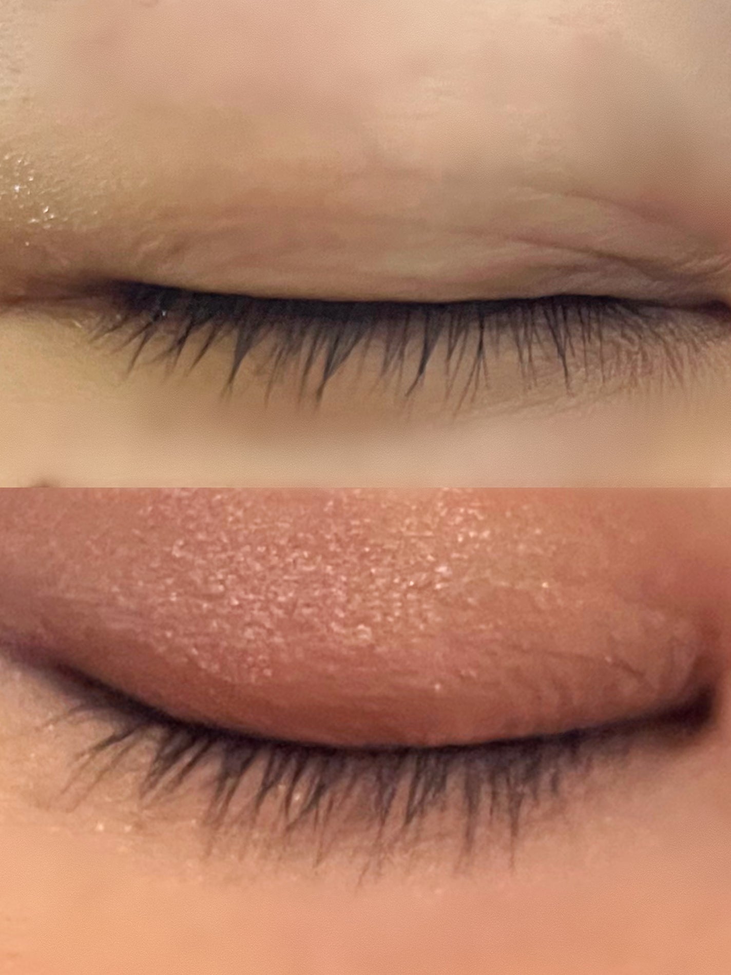 アイパワーセラム/グラングレイ/その他スキンケアを使ったクチコミ(4枚目)