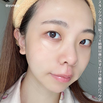 メディリフト 3Dマイクロフィラー(口元用)/YA-MAN TOKYO JAPAN/シートマスク・パックを使ったクチコミ(5枚目)