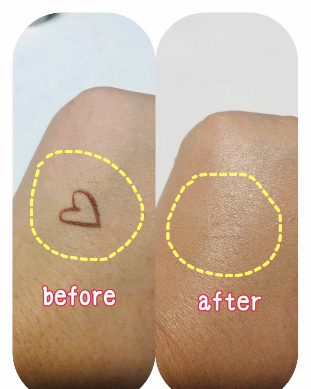 スキントリートメント ファンデーション/ナチュラグラッセ/リキッドファンデーションを使ったクチコミ（3枚目）