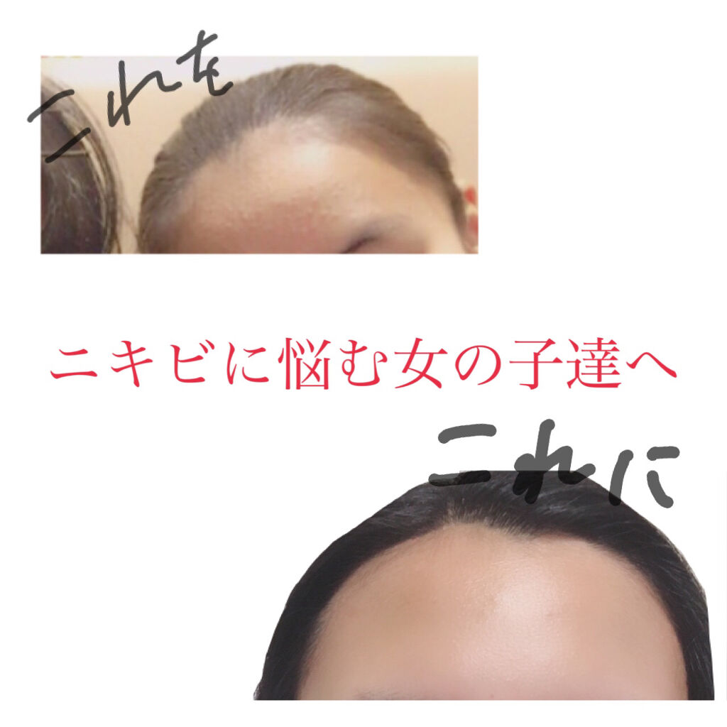 マデカソ 美容液/A’pieu/美容液を使ったクチコミ（1枚目）