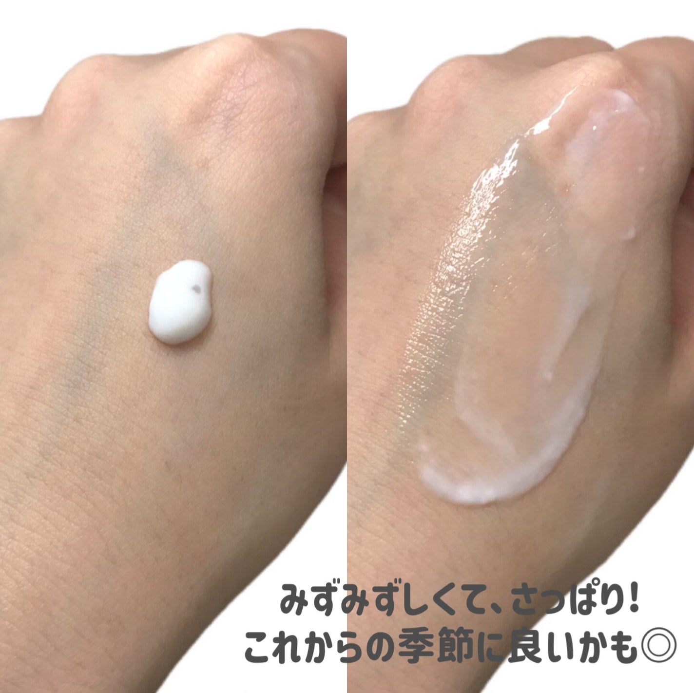 ユースキンシソラ ローション/ユースキン/ボディローションを使ったクチコミ(3枚目)