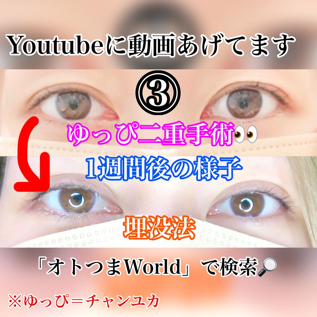 ルドゥーブル/ルドゥーブル/二重まぶた用アイテムを使ったクチコミ(1枚目)