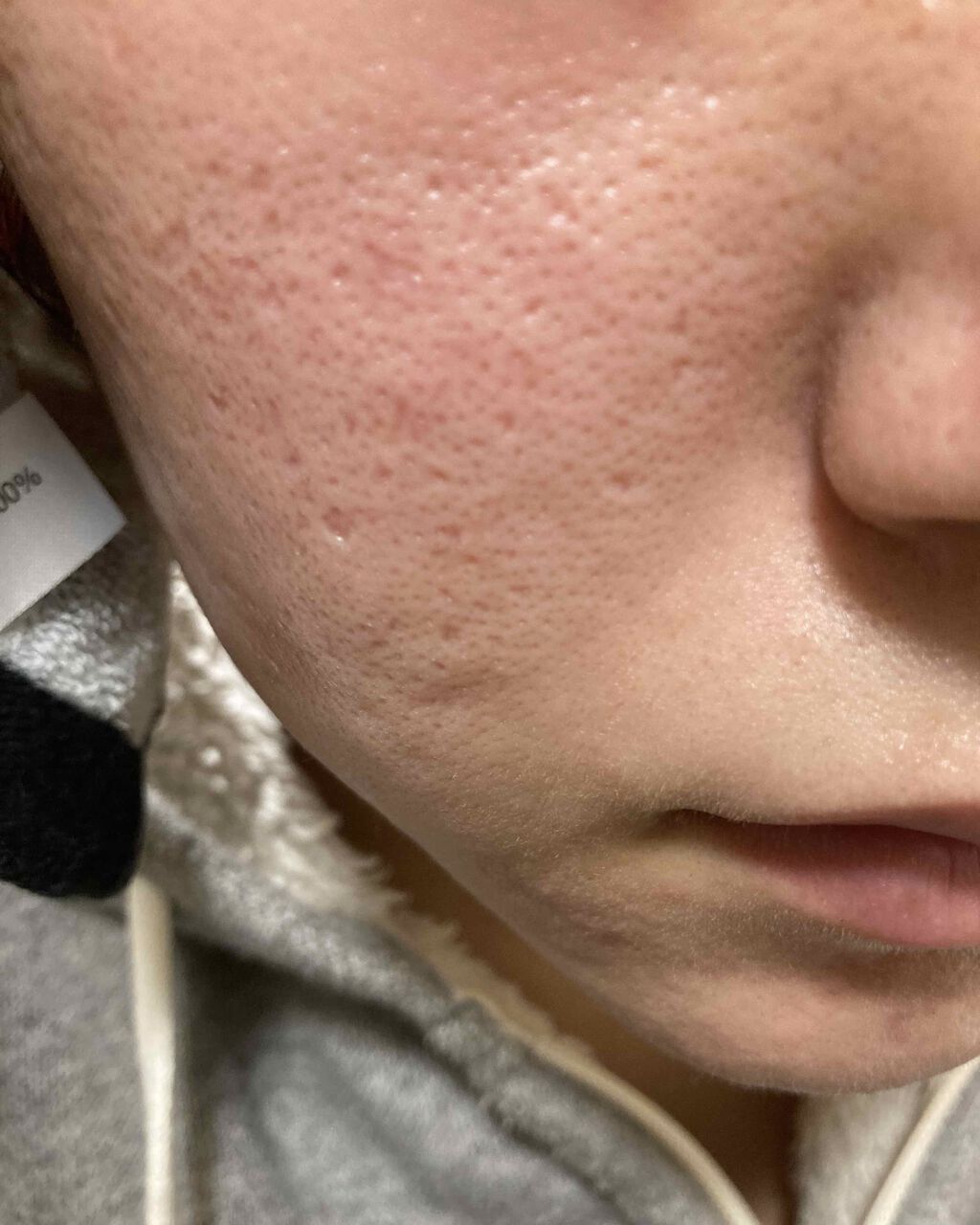 オバジC10セラム/オバジ/美容液を使ったクチコミ(4枚目)