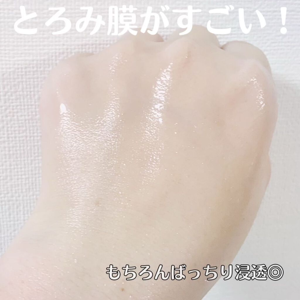 オルビスユー ローション/オルビス/化粧水を使ったクチコミ（3枚目）