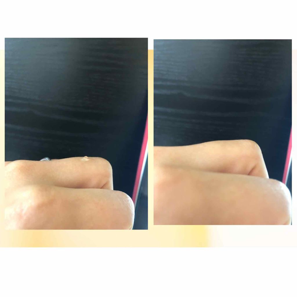 SEKKIN(セッキン)/CONTRIBUTION/除毛クリームを使ったクチコミ(2枚目)