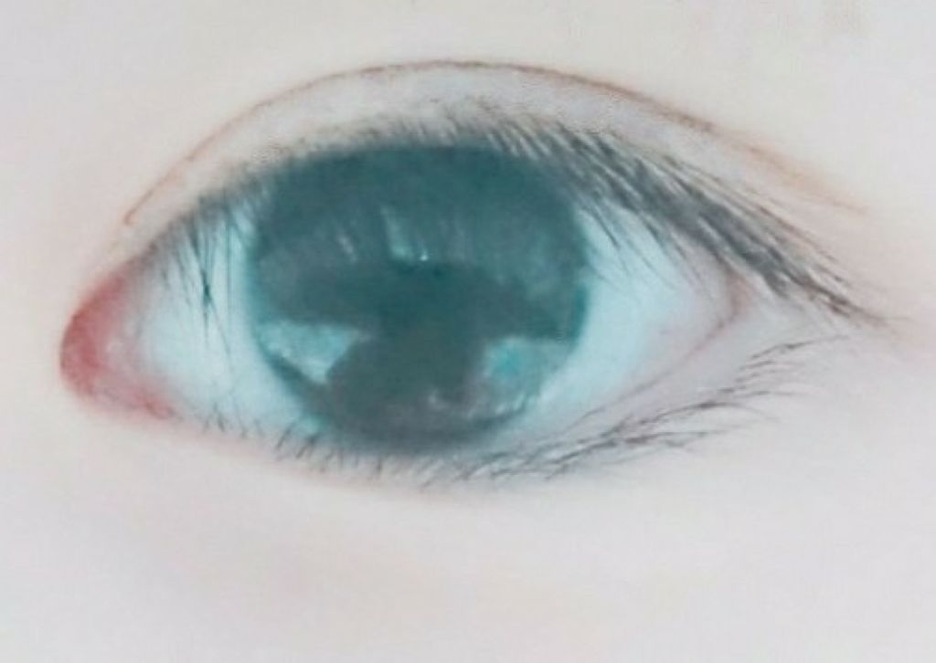 ワンダーアイリッドテープ Extra/D-UP/二重まぶた用アイテムを使ったクチコミ（3枚目）