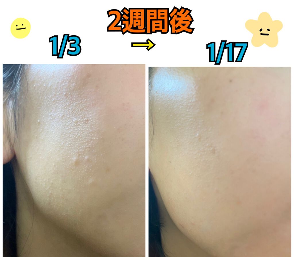 キャビアドットブースター/DEW/ブースター・導入液を使ったクチコミ（2枚目）