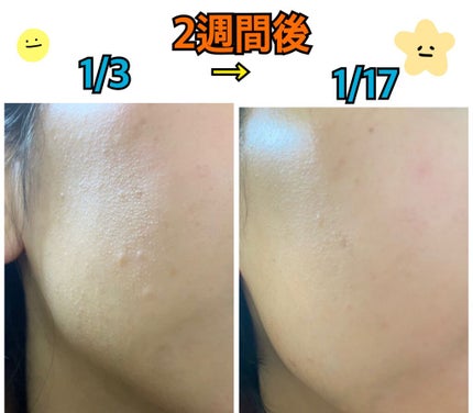 キャビアドットブースター/DEW/ブースター・導入液を使ったクチコミ(2枚目)