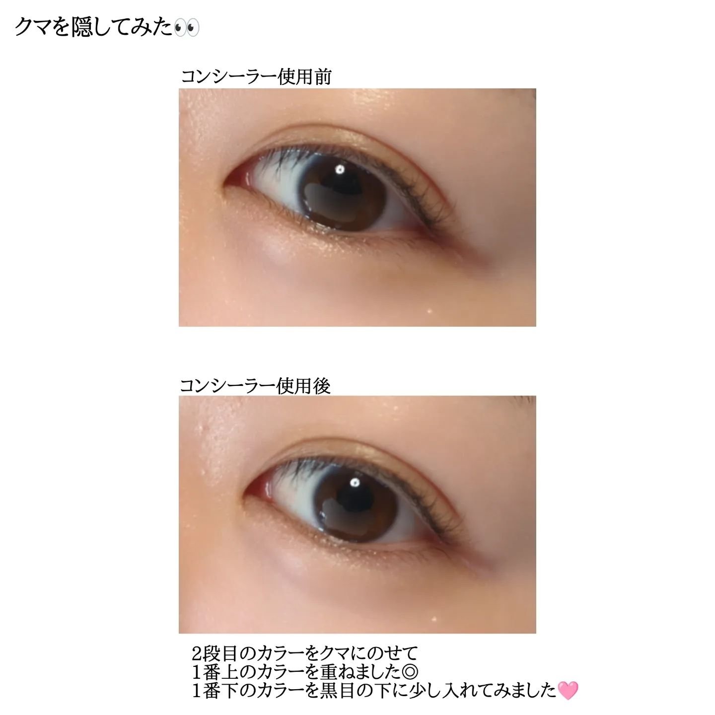 カバーパーフェクトコンシーラー/upink/パレットコンシーラーを使ったクチコミ（3枚目）