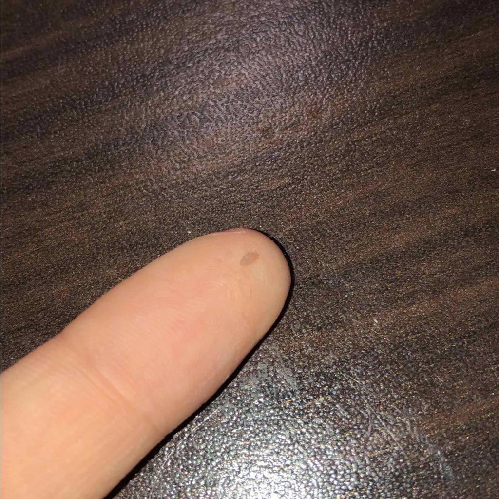 ダブルアイリッド/DAISO/二重まぶた用アイテムを使ったクチコミ（2枚目）