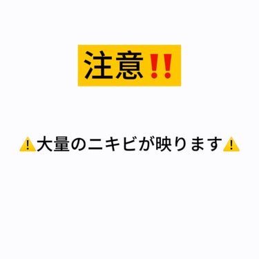 薬用ふわふわな泡洗顔/メンソレータム アクネス/泡洗顔を使ったクチコミ（2枚目）