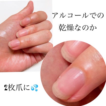 ヌーピー♡ on LIPS 「パラドゥお直しさんのネイルファンデーションBO数年前から急にな..」(2枚目)