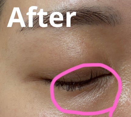 RXザ・ペプチドコラーゲン ハイドロゲルアイパッチ/COSRX/アイケア・アイクリームを使ったクチコミ(4枚目)