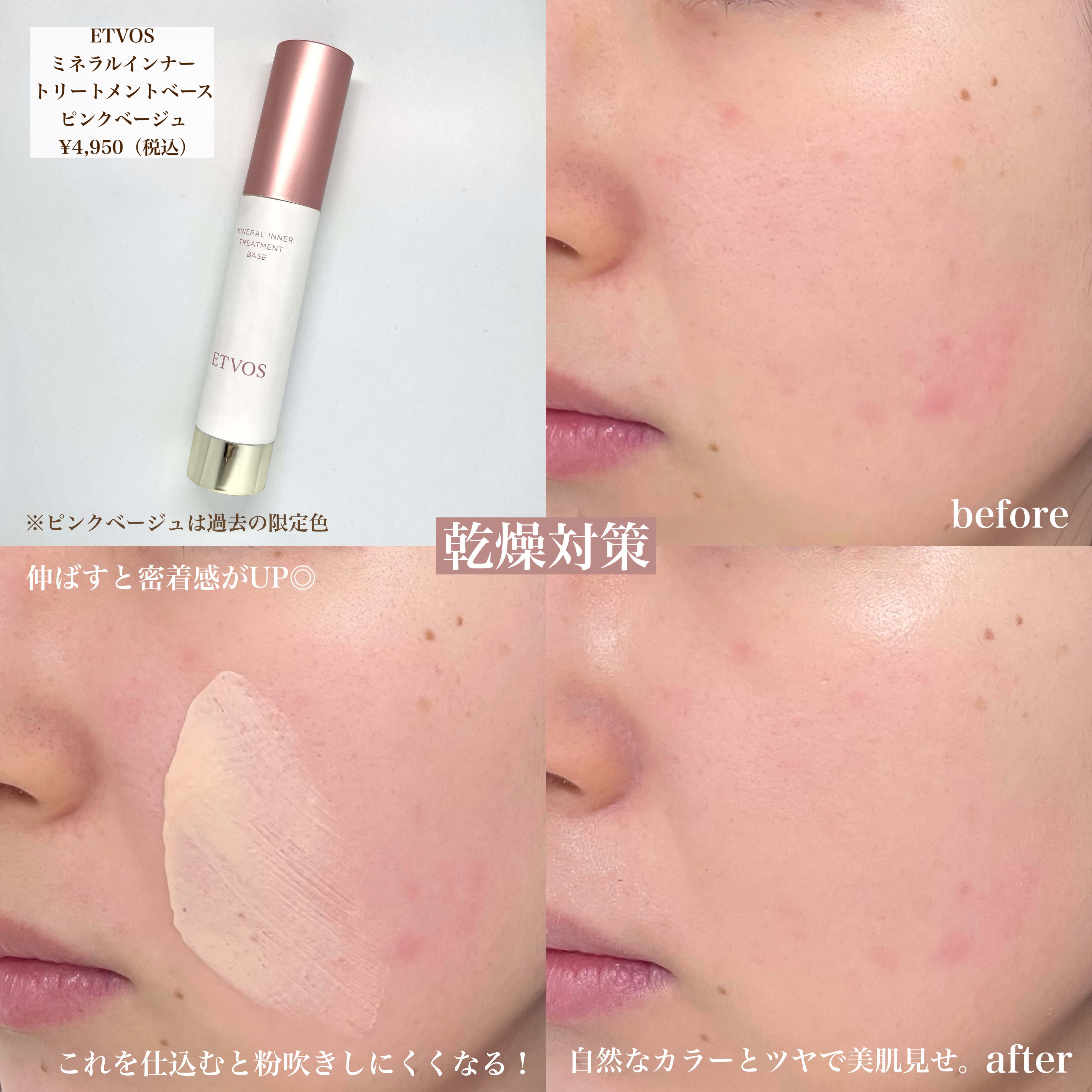 ディオールスキン フォーエヴァー スキン コレクト コンシーラー/Dior/リキッドコンシーラーを使ったクチコミ（3枚目）